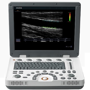 Samsung Medison MySono U6 