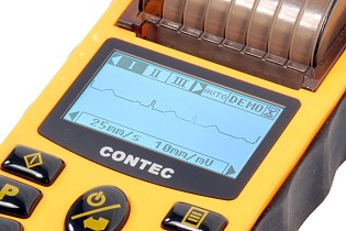 Contec ECG80A 