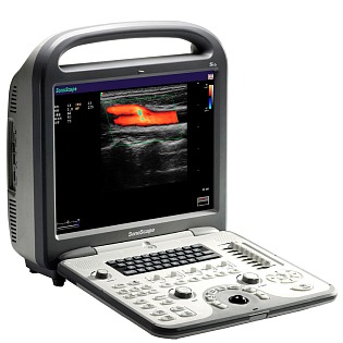 Sonoscape S6 