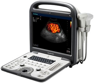 SHINOVA SonoScape S6Pro 