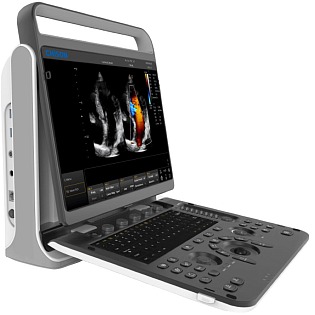 Chison SonoTouch (ST 60), (Ebit60) 