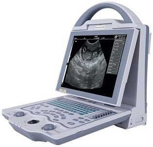 SHINOVA SonoScan E6V 