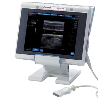 Esaote MyLab One Touch 
