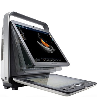 Sonoscape S9 