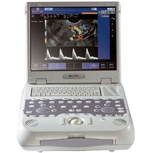 Esaote MyLab Five 