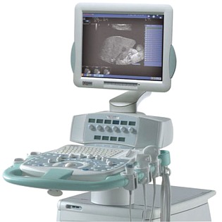 Esaote MyLab 60 