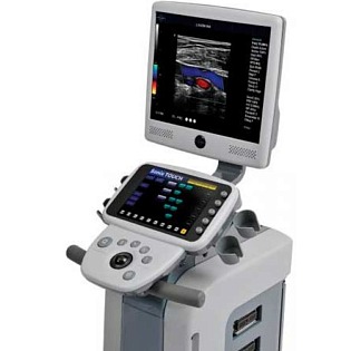 UltraSonix Sonix Touch 