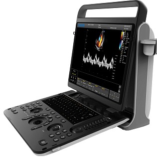 Chison SonoTouch (ST 60), (Ebit60) 