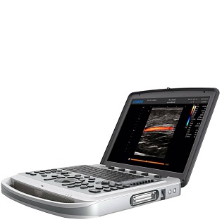 Chison SonoTouch 80, (ST 80), (SonoBook 6) 
