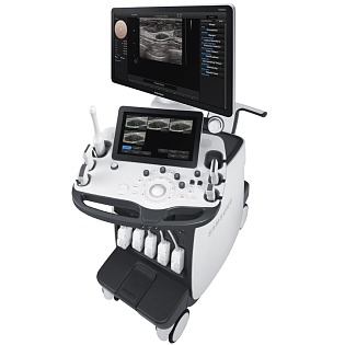 Samsung Medison RS80a 
